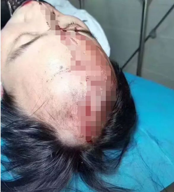 惊！泸州合江人医​发生一起暴力伤医事件，三名医生受伤~